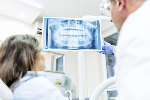 Digital Dental X-Rays in Daphne, AL at Eastern Shore Dental Associates