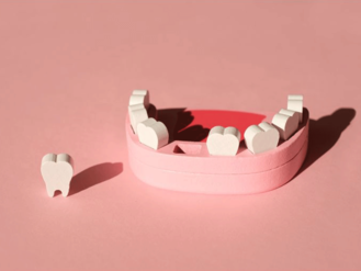 A pink dental model representing the upper jaw with several white teeth. One tooth is placed outside the model on the left side. The background is a solid pink color.